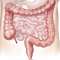Syndrome du côlon (intestin) irritable: causes, symptômes, traitement